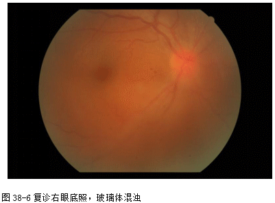 ZY016_203_3.gif